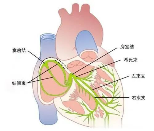 (心脏传导系统的解剖示意图)
