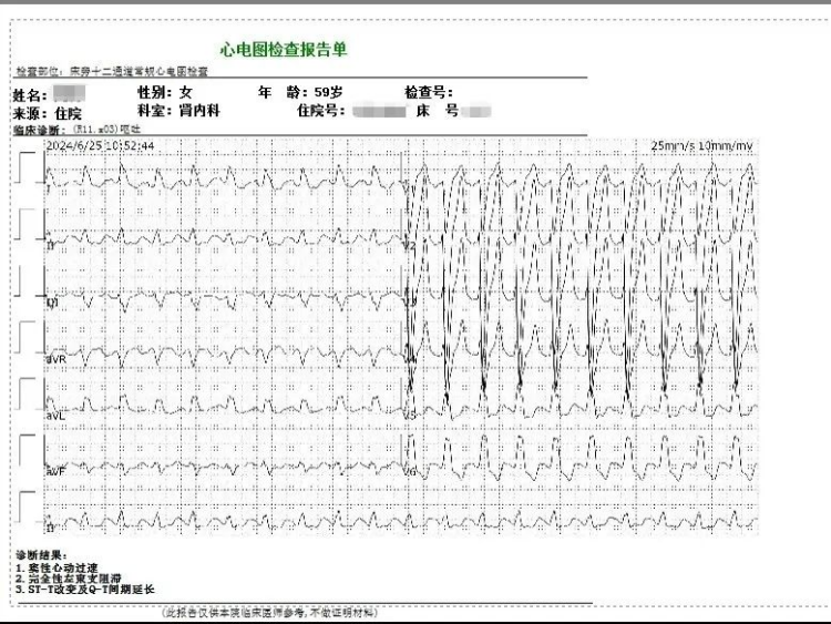 家兔高钾血症心电图图片