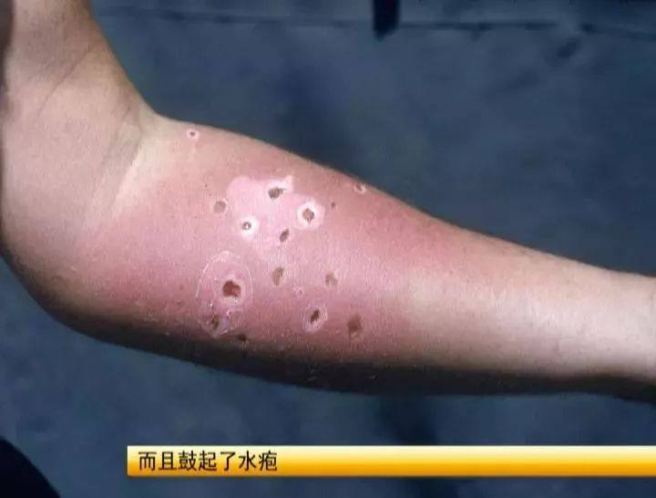 小区惊现罕见生物!严重可致命