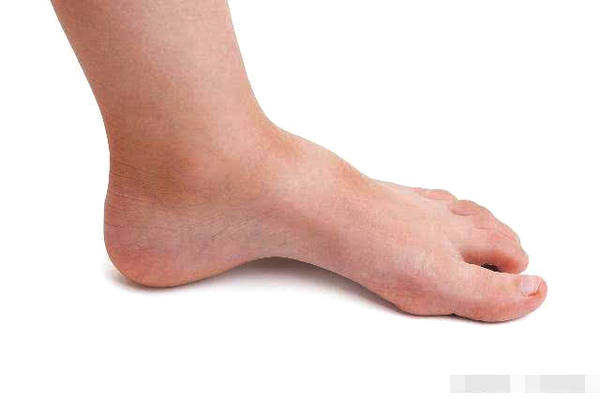 如果男人脚上没有3个表现 偷着乐吧 你的 肾功能 还不错 上游新闻 汇聚向上的力量