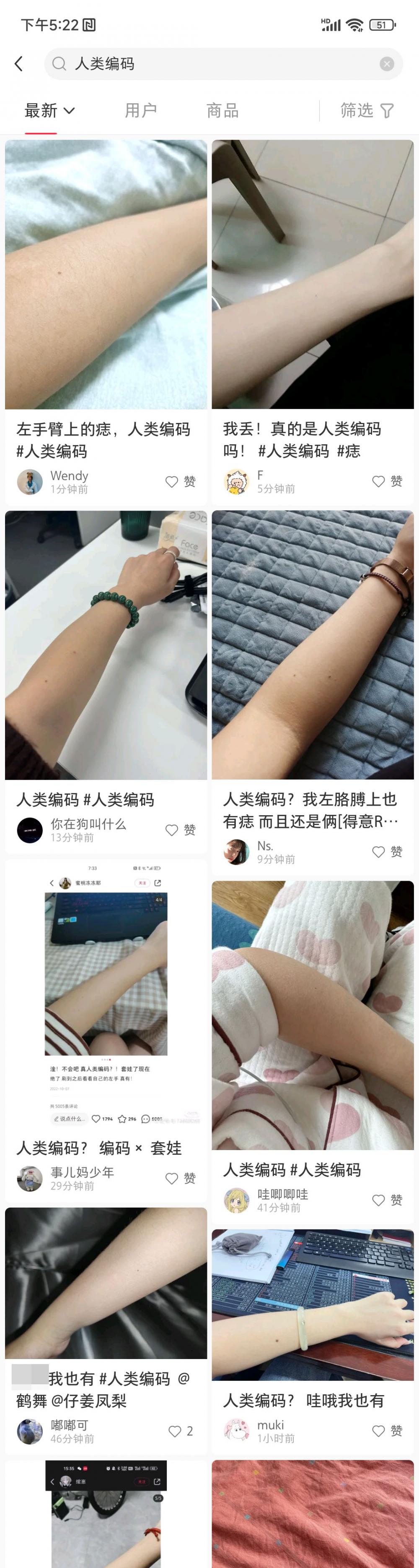 辟谣工作室| 数百网友晒出“人类编码”左前臂痣皮肤科专家：只是遇巧- 上游新闻·汇聚向上的力量