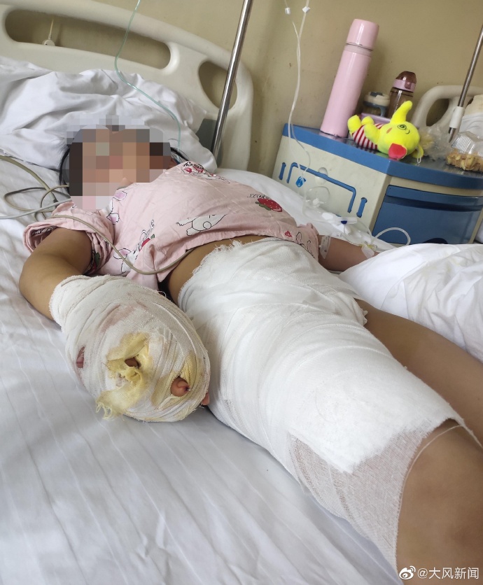 十花汤警方立案_继母涉嫌虐待继女致其残疾_警方通报13岁男孩猥亵女童
