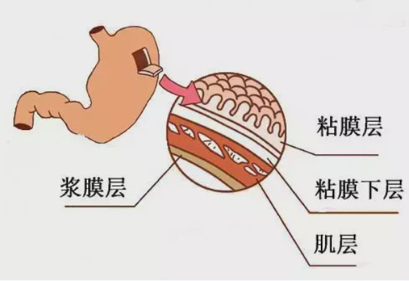 健康中国看山西 长治医学院附属和平医院完成胃壁全层切开术